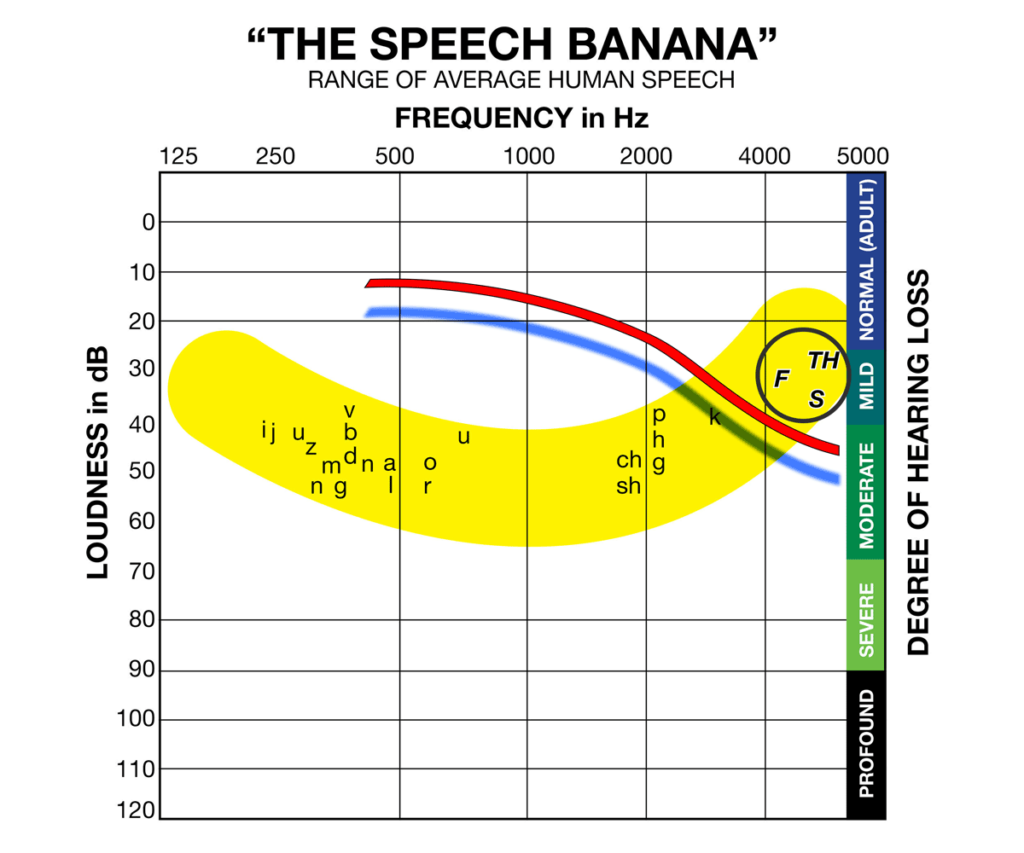 Audiogram Speech Banana Chart