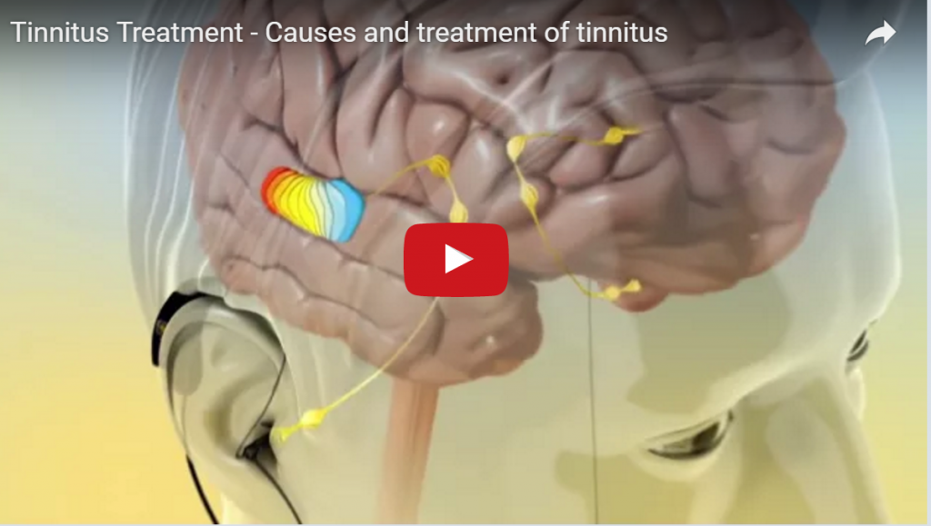 Tinnitus treatment and causes