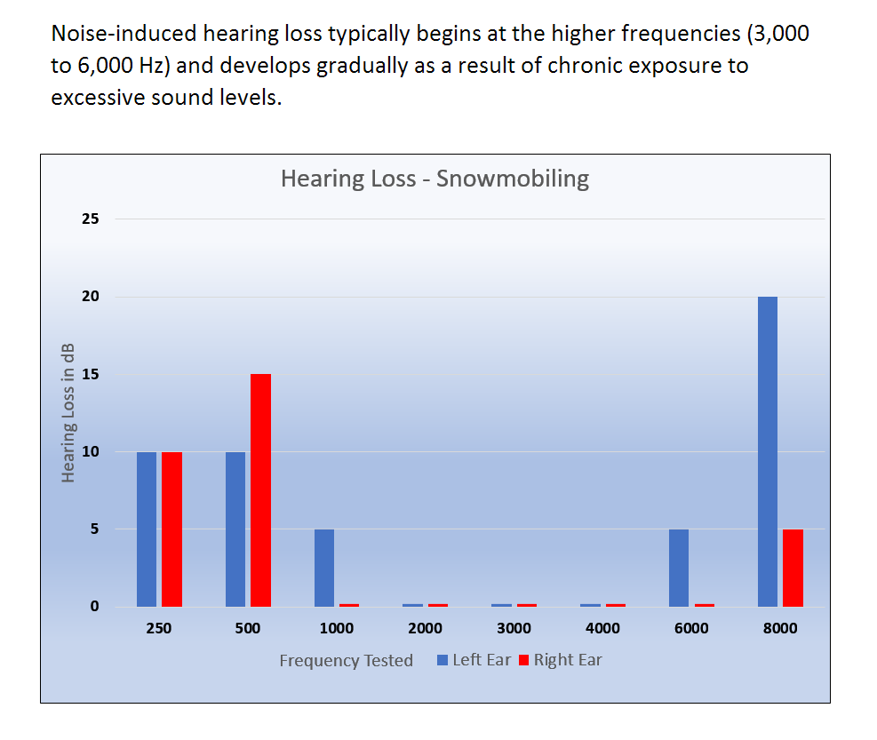 Noise Induced Hearing Loss From Snowmobiling