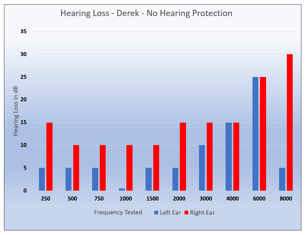 noise induced hearing loss post concert