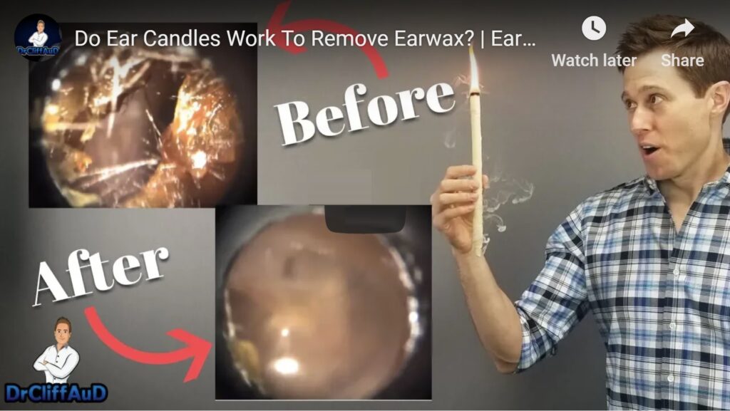 Do Ear Candles Remove Ear Wax