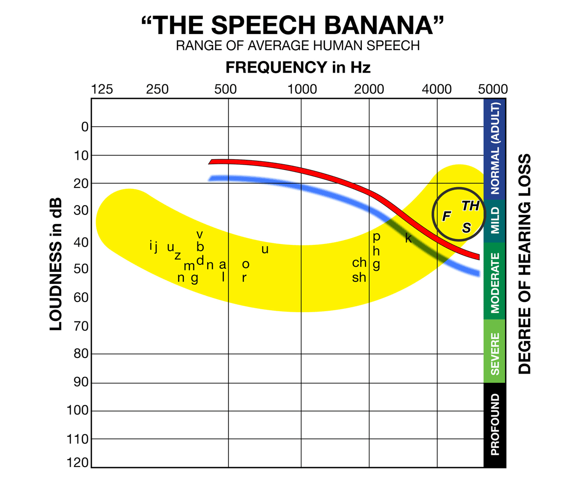 speech-banana-red-line-circled-for-mild-hearing-loss-hearing-aids-testing-polo-park